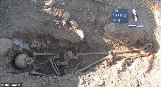 Das 1.000 Jahre alte Skelett wurde in einem elliptischen Grab in Portugal entdeckt.  Das Team extrahierte DNA aus den Überresten, um zu zeigen, dass der Mann das Klinefelter-Syndrom hatte.  Was passiert, wenn es ein zusätzliches X-Chromosom gibt